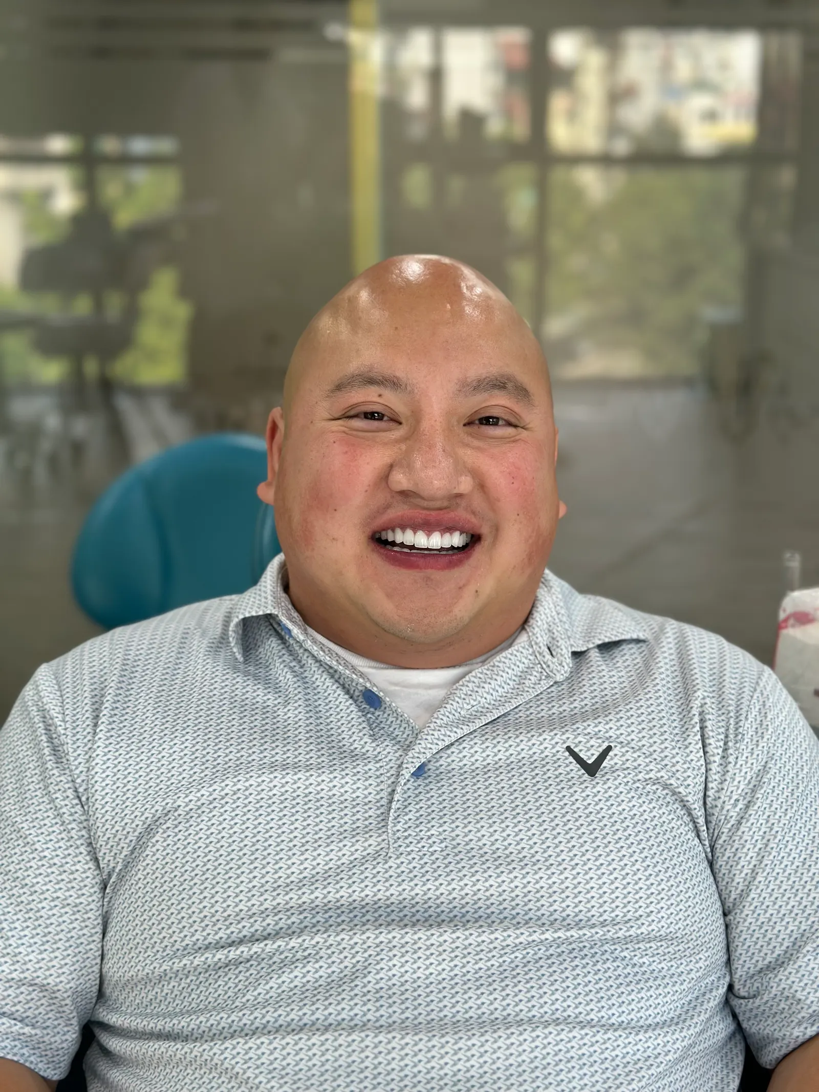 A brighter smile with a natural look Before