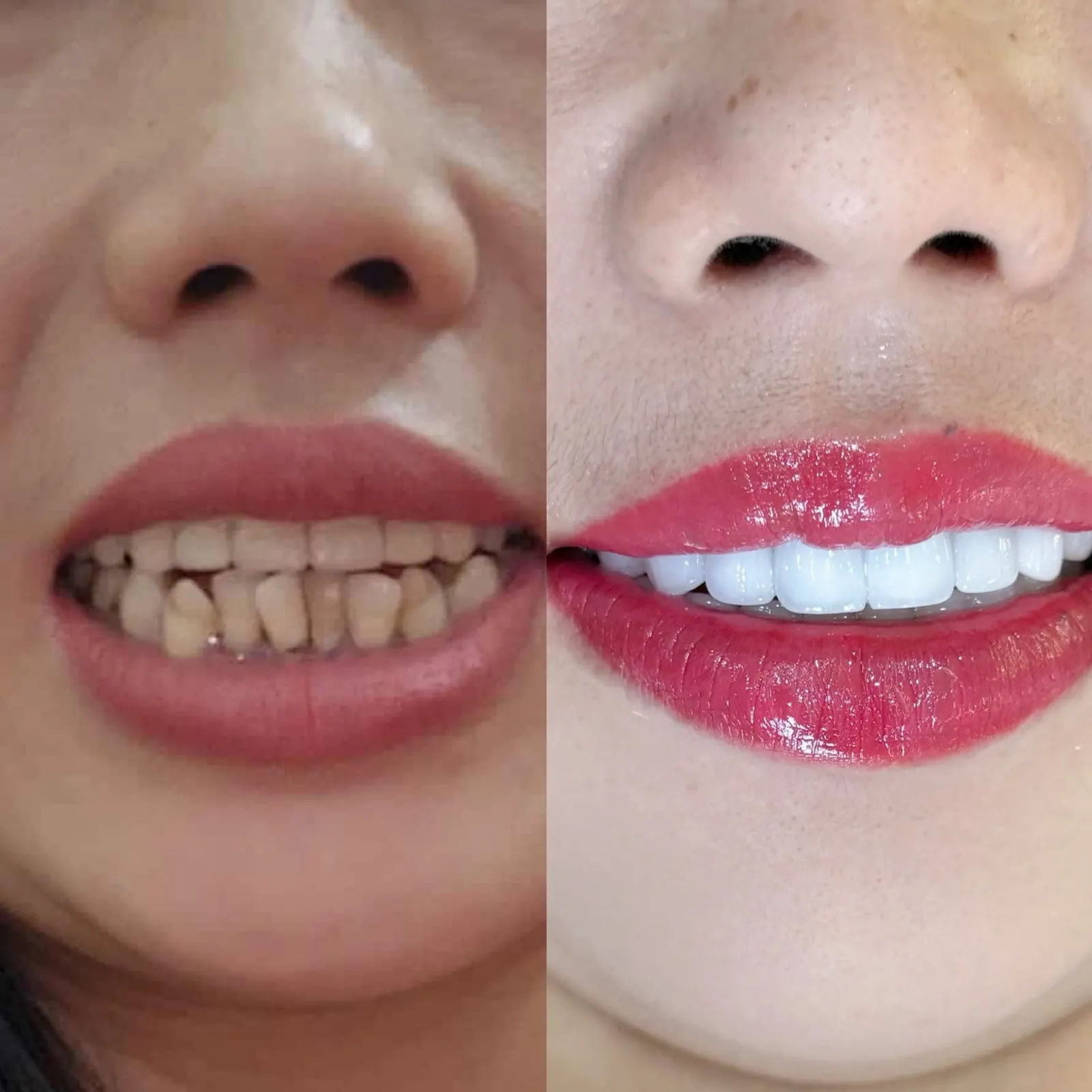 A smile designed around personal goals After